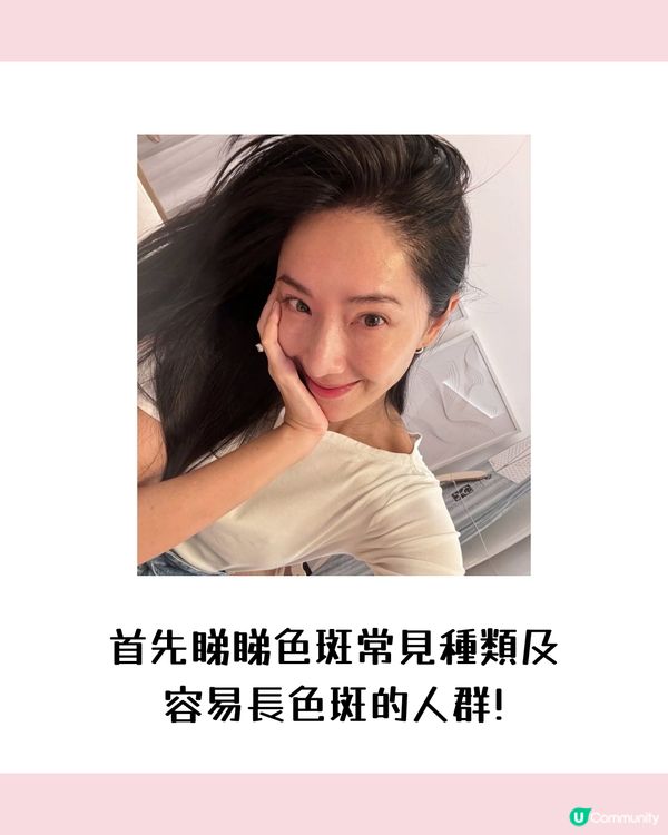 【色斑預防攻略】6個習慣令斑點不再來！6大成因☀️4類人容易長斑！