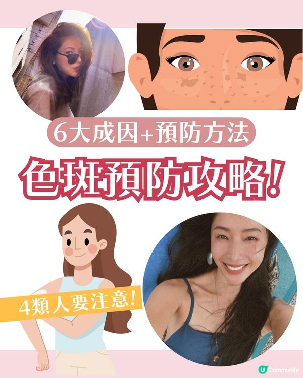 【色斑預防攻略】6個習慣令斑點不再來！6大成因☀️4類人容易長斑！