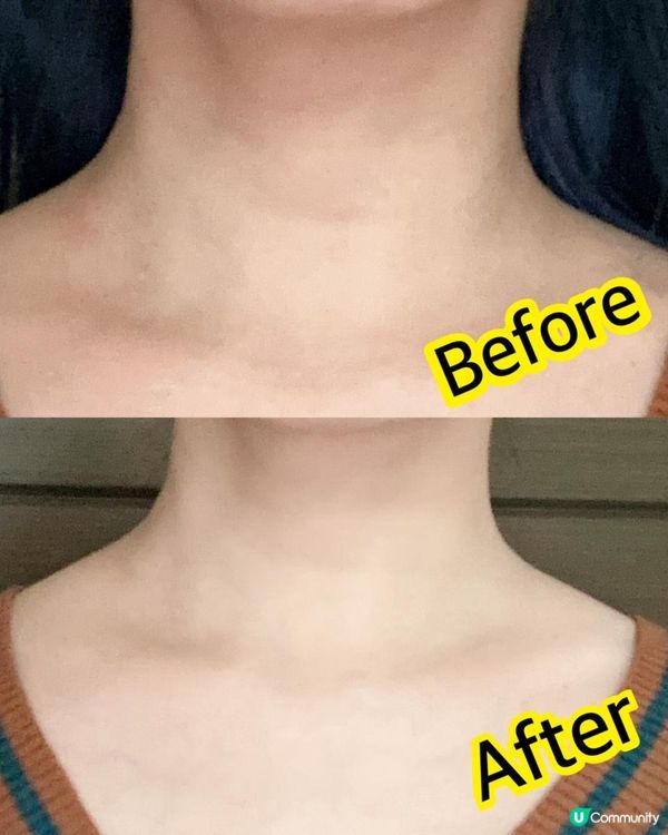 抗衰老神器 ♥ 亮白胸頸・減淡頸紋！►CurrentBody Skin LED光療亮白胸頸美容儀