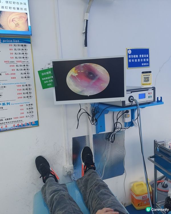 😬😬😬深圳采耳