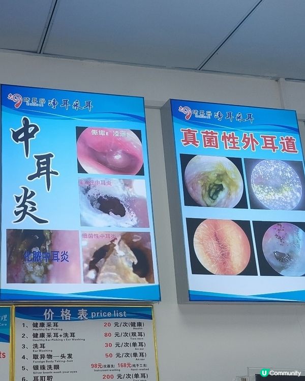 😬😬😬深圳采耳