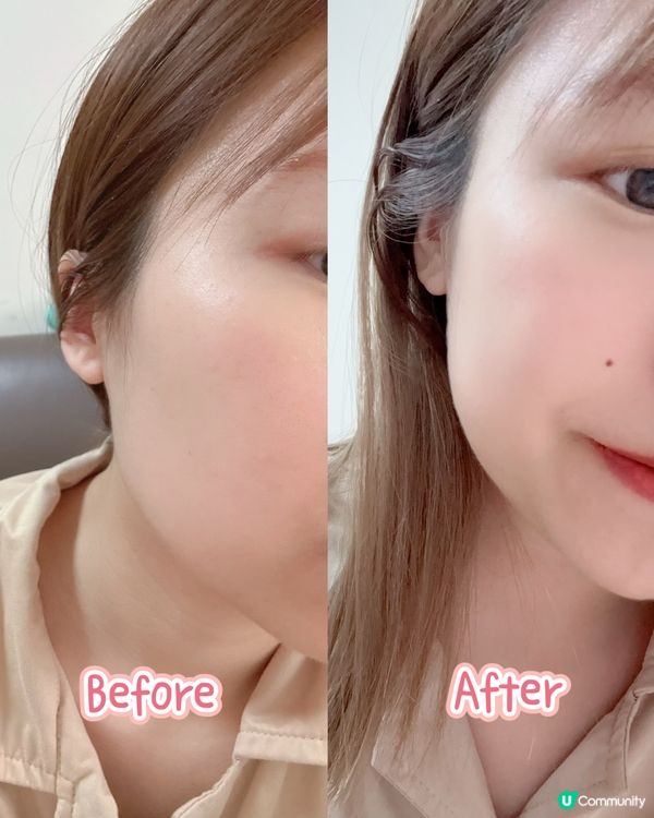 做完醫美急救？🔥  可复美幫你降紅舒敏！