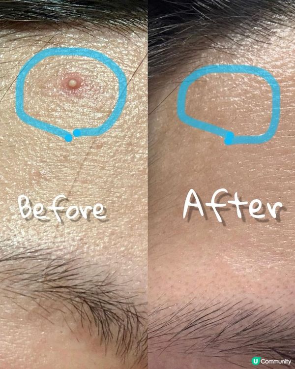 ## 9個月保養成果大公開🤩  
## 告別暗沉，重拾光彩✨