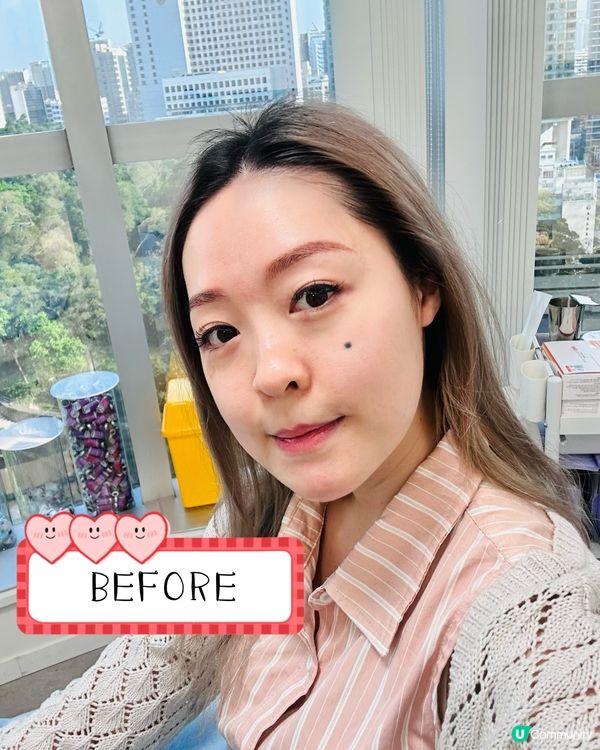 《醫美微調手記|水光針✖溶脂針の低調變美哲學》  