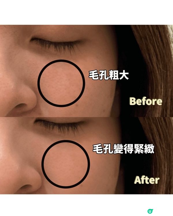 【⁠Meditherapy｜光感煥膚修護精華】