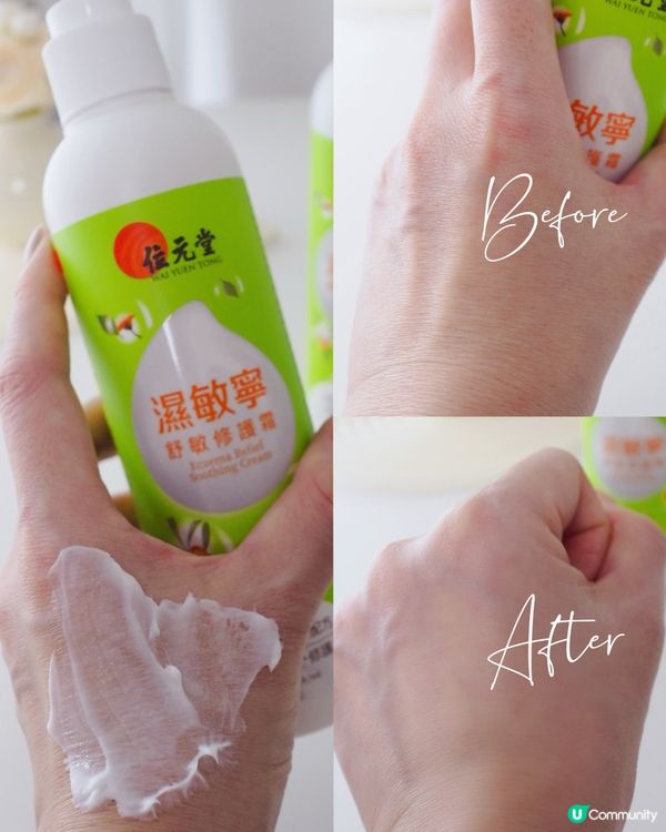 一轉季敏感又發作😭肌膚特別乾燥又痕💗周身唔舒服~真係會影響心...