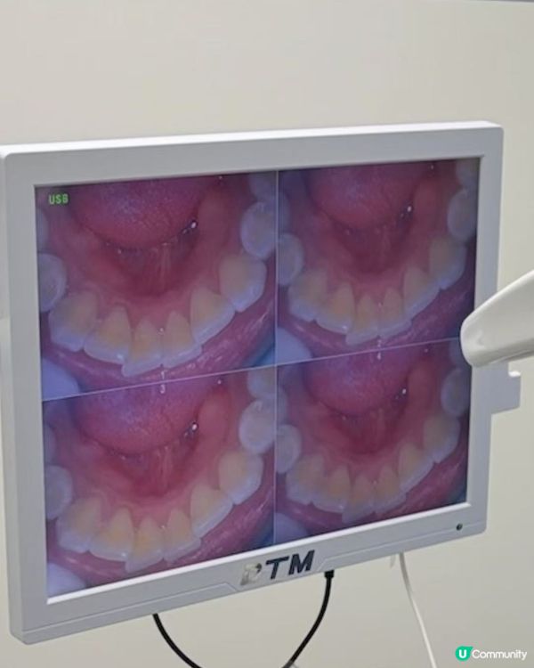 今次已經係第二次來格倫菲爾!上次自己來洗牙