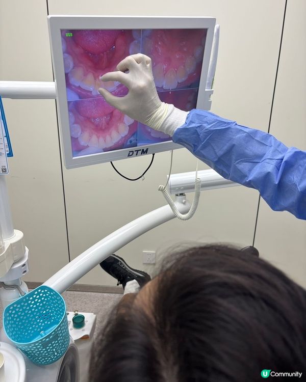 今次已經係第二次來格倫菲爾!上次自己來洗牙