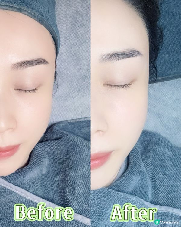 ✨ 煥然一新，肌膚重拾光彩 ✨