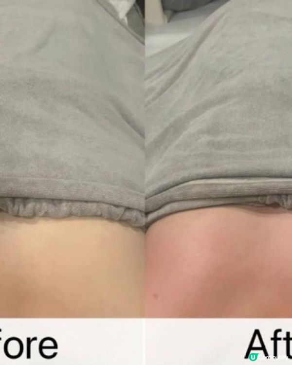 💛Yanki日瑩🤍全港首創🇯🇵日本NMN豐胸產品療程