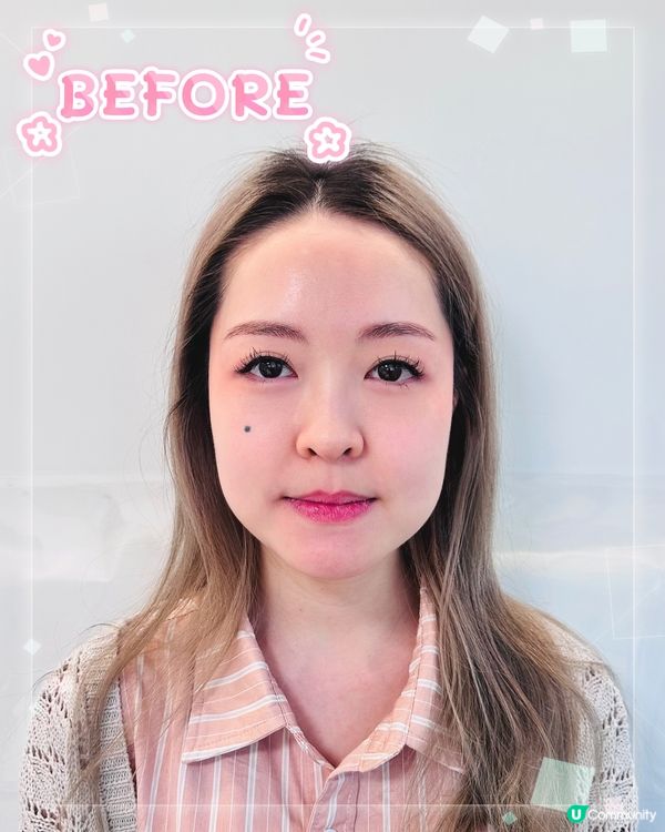 《醫美微調手記|水光針✖溶脂針の低調變美哲學》  