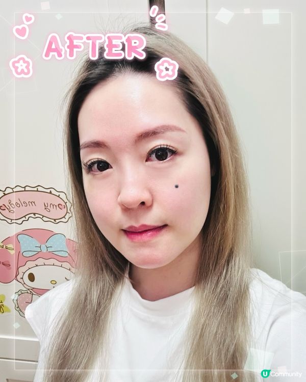 《醫美微調手記|水光針✖溶脂針の低調變美哲學》  