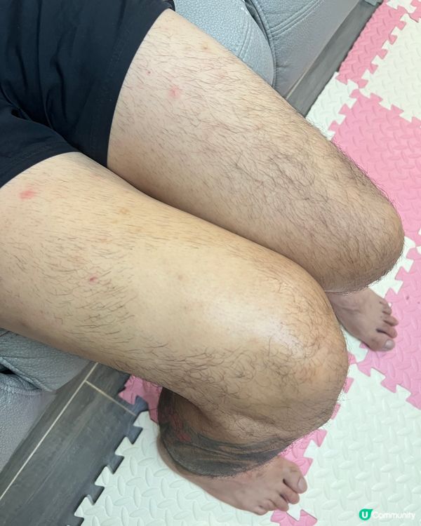 夏天著小背心，腋下唔怕有海膽！ ☀️😎