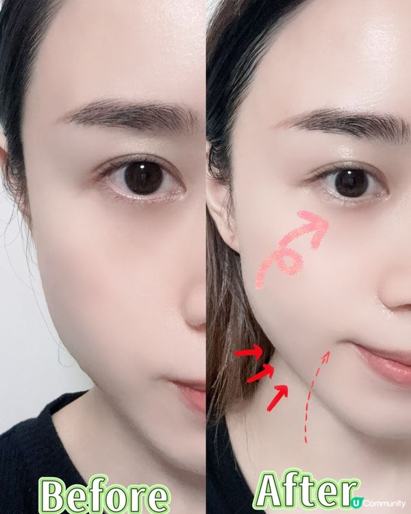 醫美級護膚新革命🔥  眼膜面膜組合