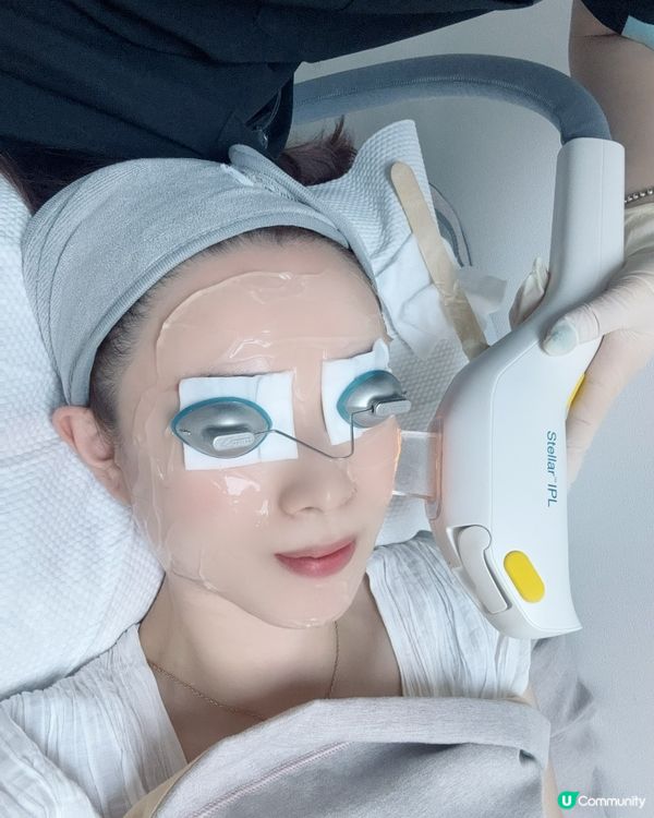 ## 二代美版超聲刀🤩  銅鑼灣體驗分享！