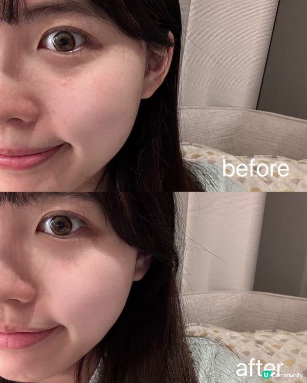 敏感肌救星🌟全城熱話麗珠蘭護膚品用後感🔍