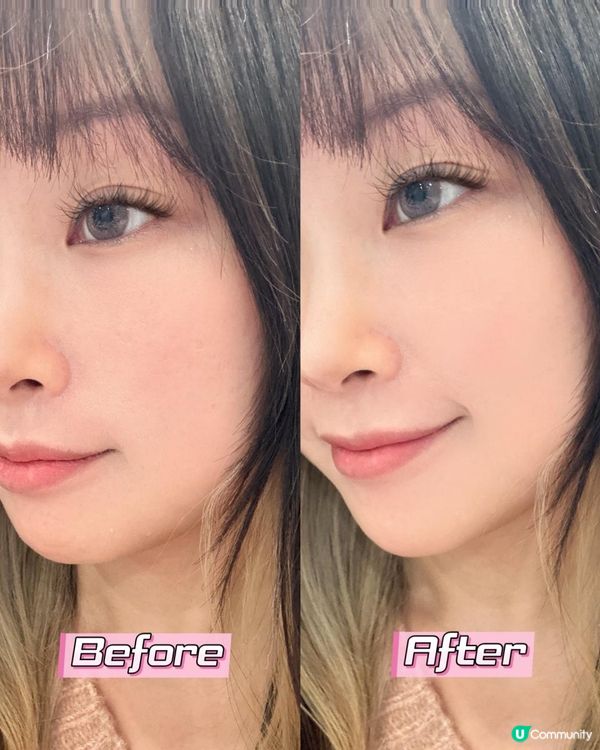 ♡ LA WELLIS CICA EXOSOME™｜高濃度瑞士外泌體精華♡