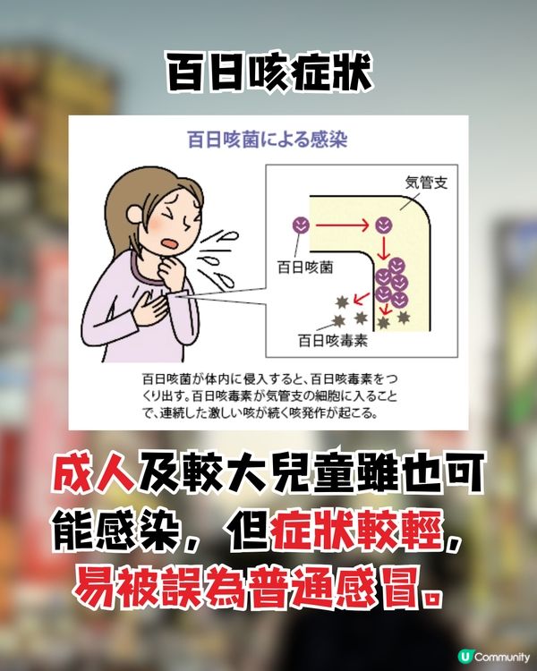 日本百日咳|突破近1.2萬人感染 連續5週新高！6地病例最多？！