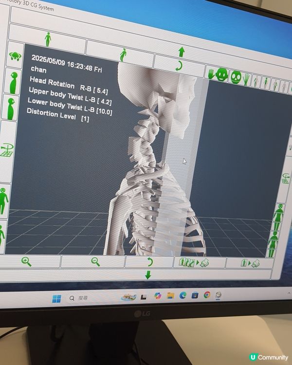 免費試做AI 360自動痛症追蹤