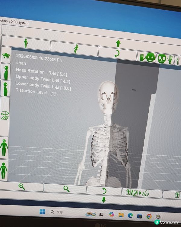 免費試做AI 360自動痛症追蹤