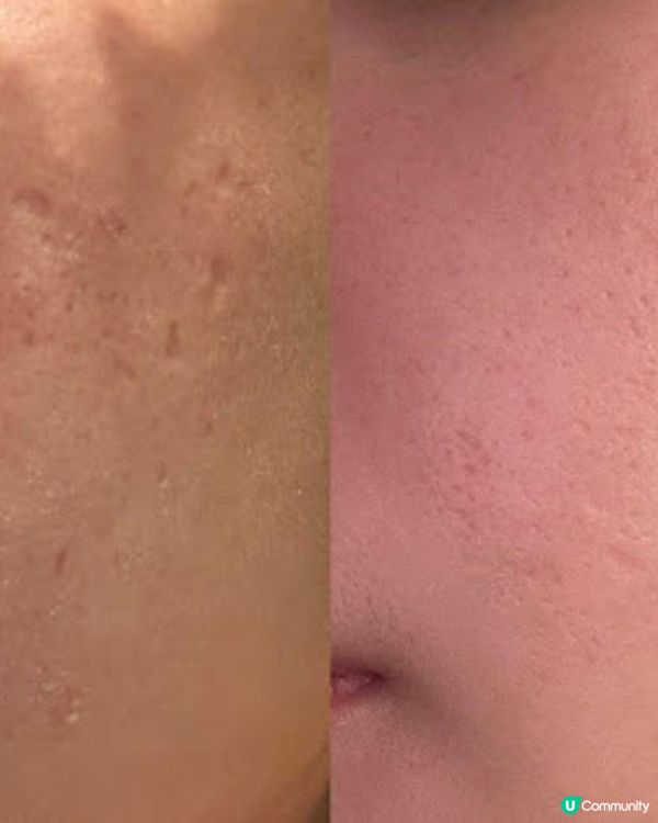 一文看清 0 plus clinic Juvelook + 麗珠蘭