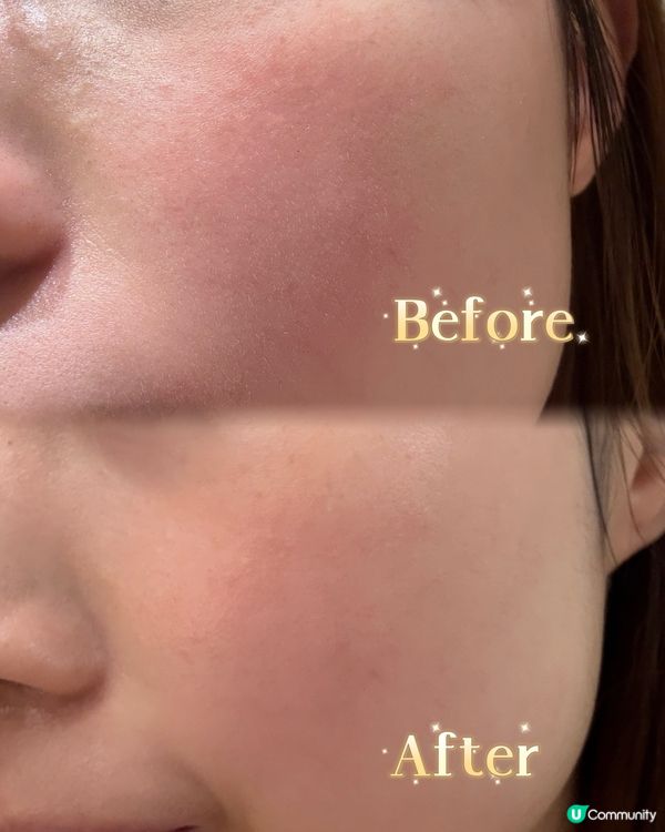 皮膚敏感救星🌟  小店自家研發護膚產品