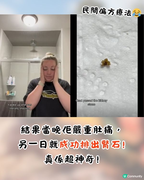 網上熱議超爆笑迪士尼正骨法🎢研究證過山車可排腎石⁉️網民: 灰熊山谷最有效果😂