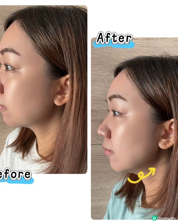 【 功能性高的ZIIP HALO納米微電流緊膚儀 】