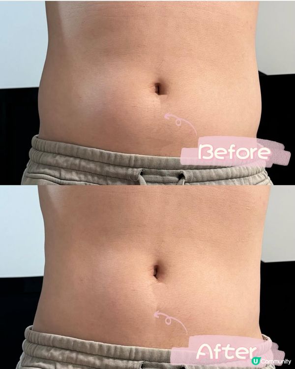 💪🏻💪🏻 濕氣重？綠養坊幫你KO！