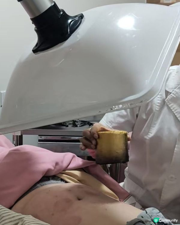 90 後熬夜後遺症實錄