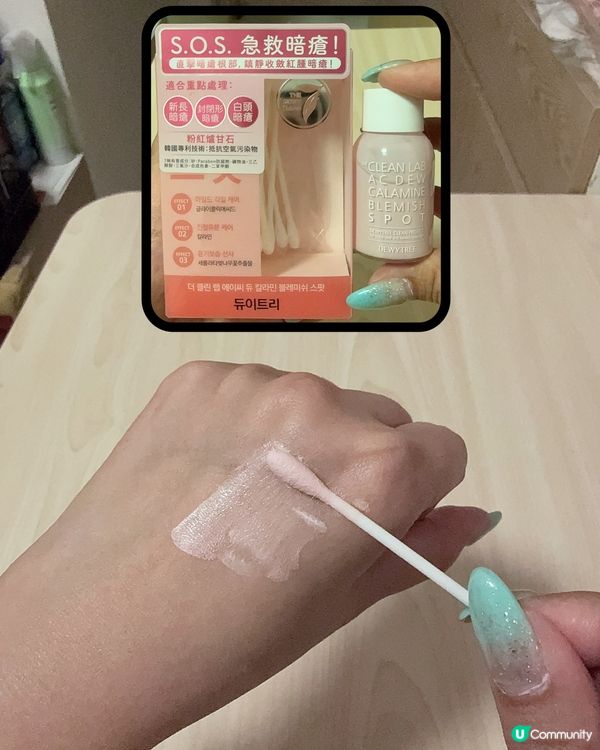 爐甘石強效祛痘消炎粉急救暗瘡‼️