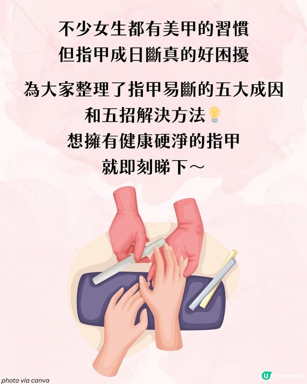 指甲成日斷？指甲脆弱5大成因 + 解決方案 附好物推介💅🏻