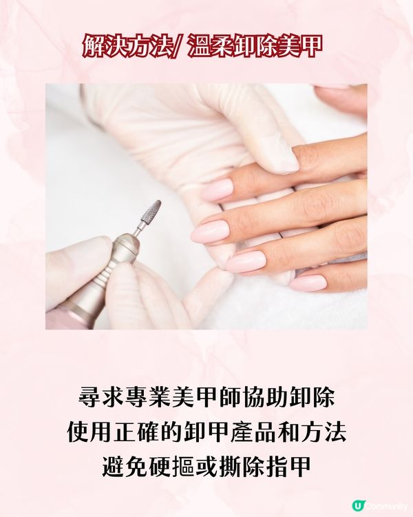 指甲成日斷？指甲脆弱5大成因 + 解決方案 附好物推介💅🏻