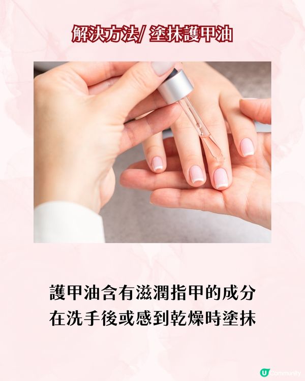 指甲成日斷？指甲脆弱5大成因 + 解決方案 附好物推介💅🏻