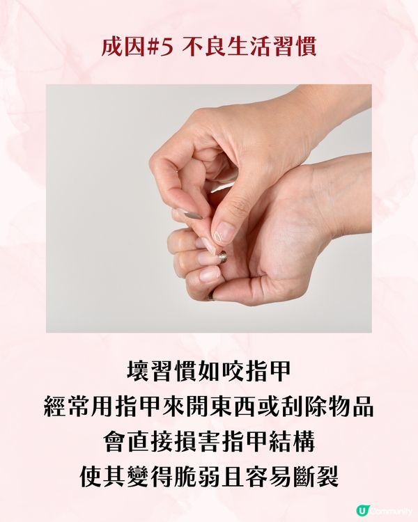 指甲成日斷？指甲脆弱5大成因 + 解決方案 附好物推介💅🏻