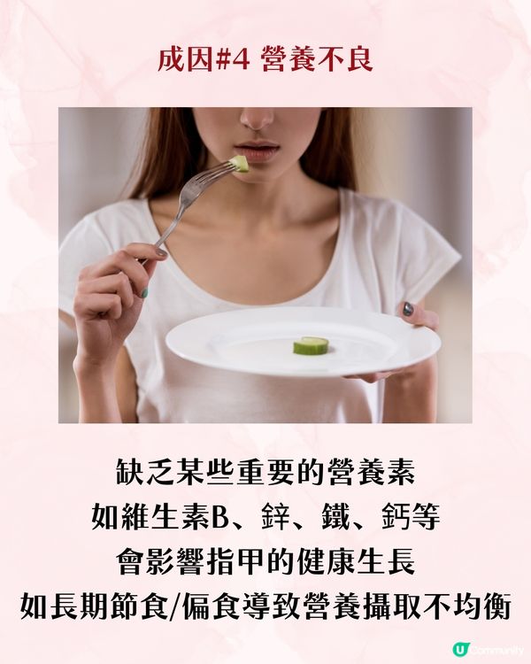 指甲成日斷？指甲脆弱5大成因 + 解決方案 附好物推介💅🏻