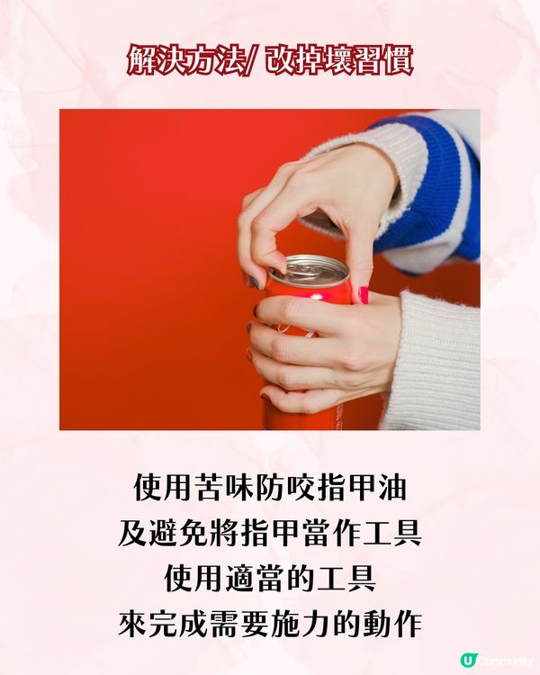 指甲成日斷？指甲脆弱5大成因 + 解決方案 附好物推介💅🏻