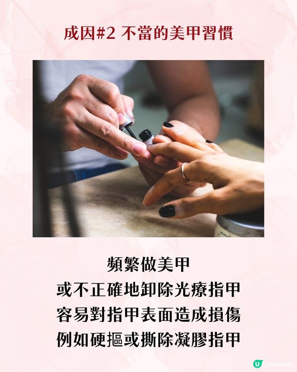 指甲成日斷？指甲脆弱5大成因 + 解決方案 附好物推介💅🏻