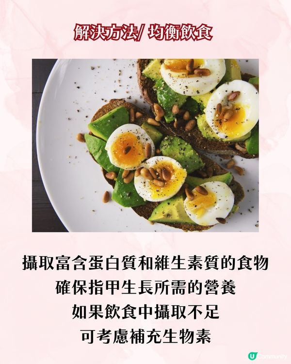 指甲成日斷？指甲脆弱5大成因 + 解決方案 附好物推介💅🏻