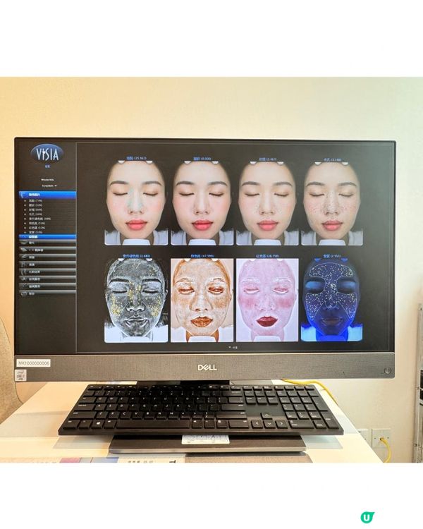 幫面部肌肉做運動！Jovena FaceStim®️深層面肌運動療程分享