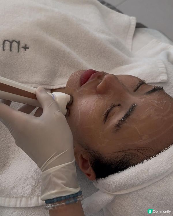 幫面部肌肉做運動！Jovena FaceStim®️深層面肌運動療程分享