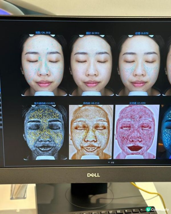 面部普拉提體驗分享💗Jovena FaceStim®️深層面肌運動療程