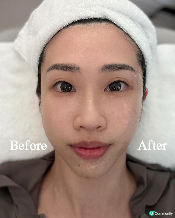 面部普拉提體驗分享💗Jovena FaceStim®️深層面肌運動療程