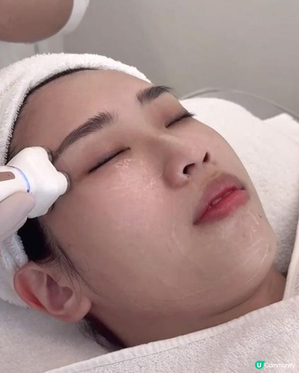 面部普拉提體驗分享💗Jovena FaceStim®️深層面肌運動療程