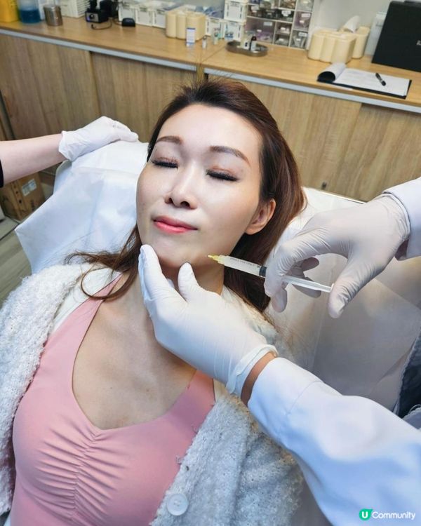 Juvelook素顏針流程+效果 0plus Clinic