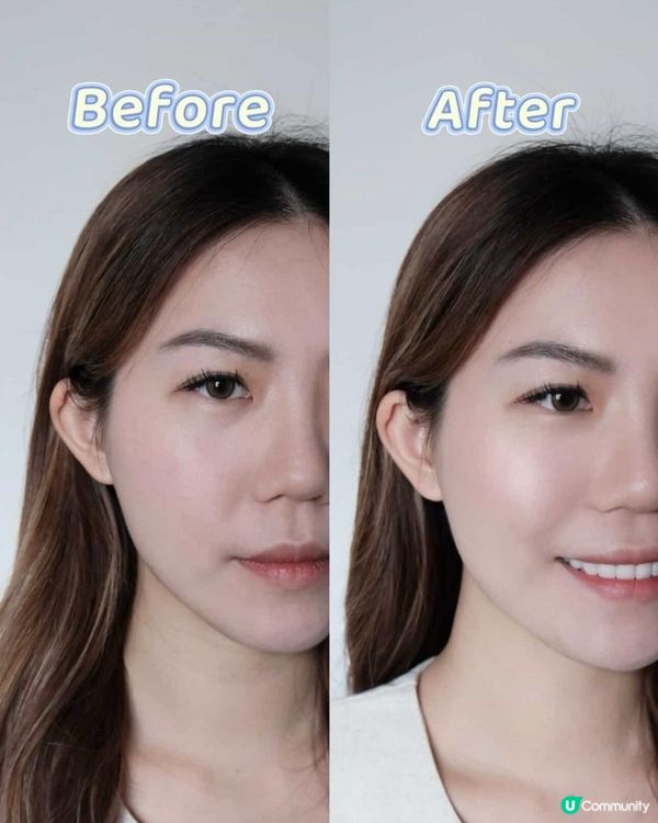 修復肌底，La Wellis Exosome打造細滑新肌