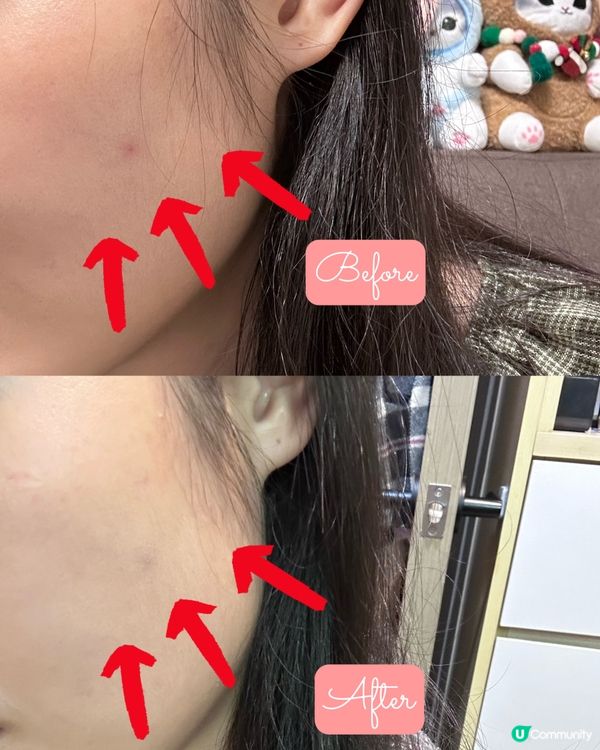 同陽光☀️玩遊戲，但曬黑左，岀色斑點算好呀🥹