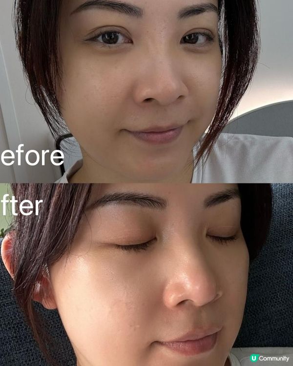 39+1保養不偷懶！實試Jovena FaceStim®️深層面肌運動療程