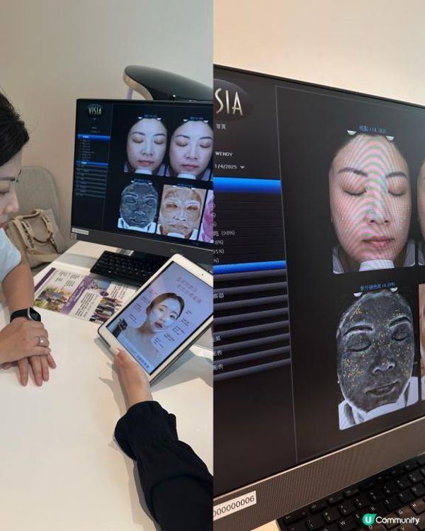 39+1保養不偷懶！實試Jovena FaceStim®️深層面肌運動療程