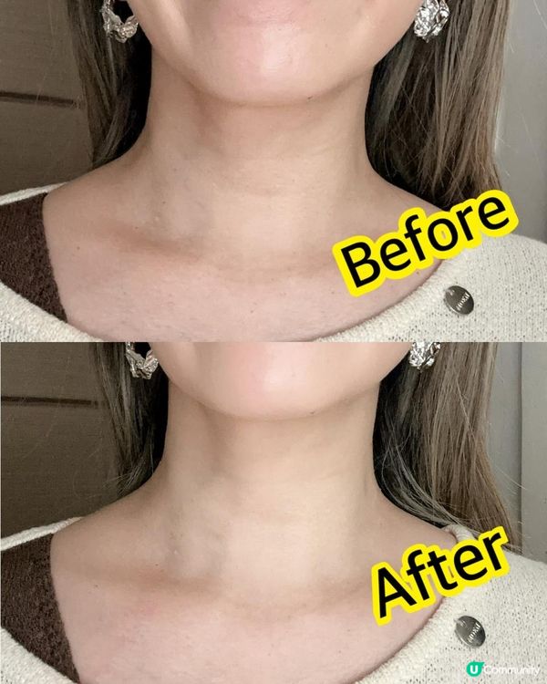 一次見效 ♥ 減淡頸紋法寶！►韓國SL LIGHT【A醛逆齡袪頸紋膜】